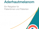 NVKH veröffentlicht Patientenbroschüre zum Aderhautmelanom