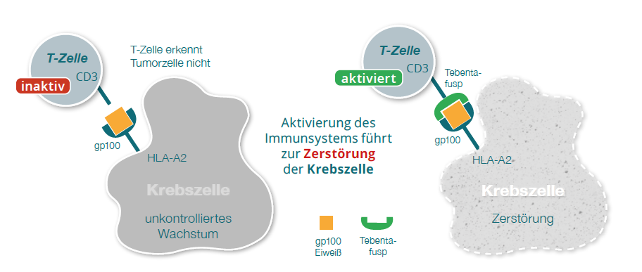 skinfo_tebentafusp