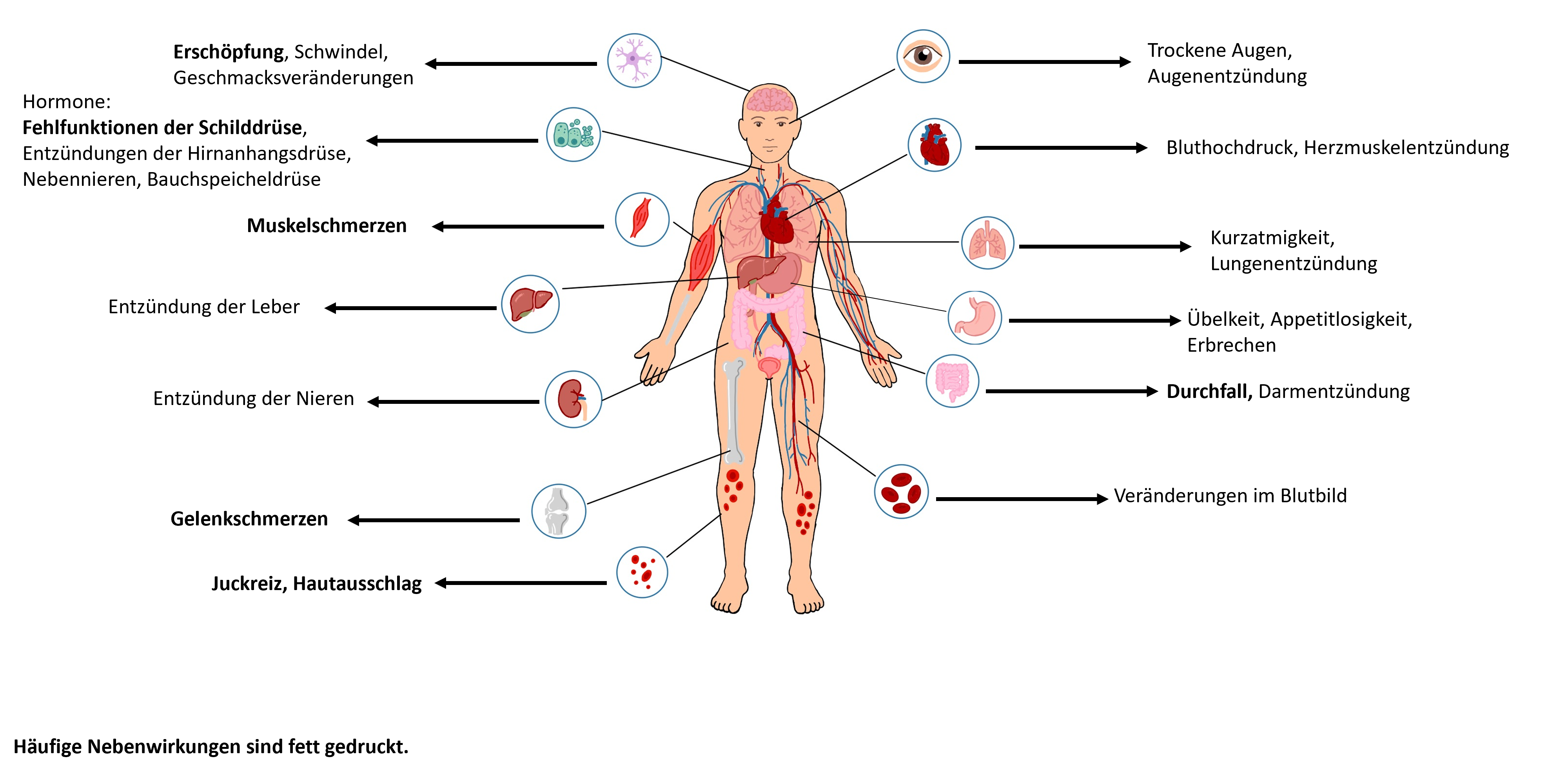 NW_Immuntherapie NW_Immuntherapie